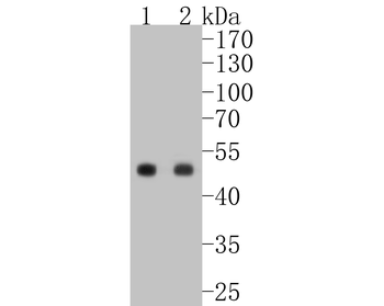 PAX6 Recombinant Rabbit Monoclonal Antibody