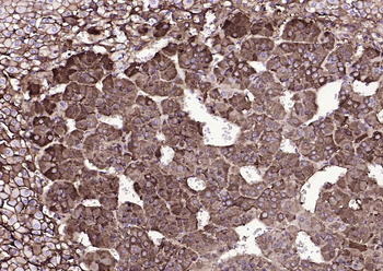 Tyrosine Hydroxylase Recombinant Rabbit Monoclonal Antibody