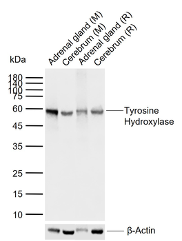 Tyrosine Hydroxylase Recombinant Rabbit Monoclonal Antibody