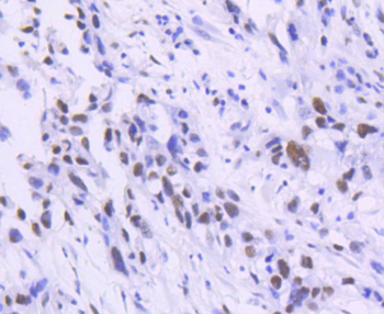 TCF7L2 Recombinant Rabbit Monoclonal Antibody