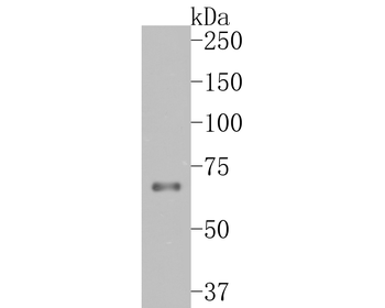 TCF7L2 Recombinant Rabbit Monoclonal Antibody