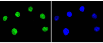 Ku80 Recombinant Rabbit Monoclonal Antibody
