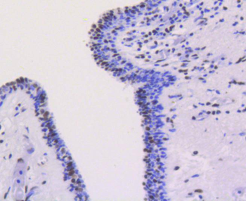 Ku80 Recombinant Rabbit Monoclonal Antibody