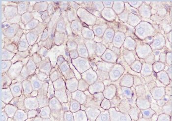 N Cadherin Recombinant Rabbit Monoclonal Antibody