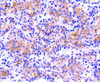 ITGB3 Recombinant Rabbit Monoclonal Antibody