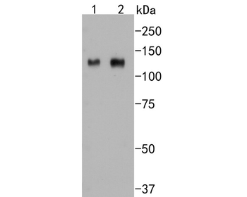 ITGB3 Recombinant Rabbit Monoclonal Antibody