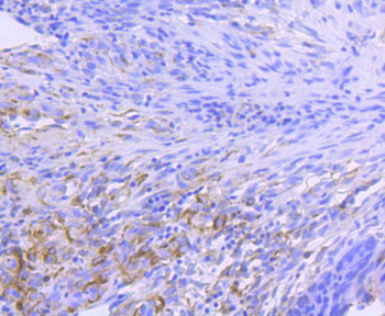 Hsp90 alpha Recombinant Rabbit Monoclonal Antibody