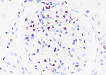 ERG Recombinant Rabbit Monoclonal Antibody