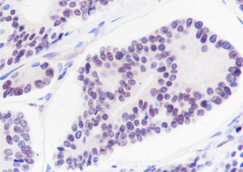 ERG Recombinant Rabbit Monoclonal Antibody