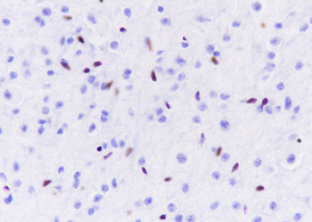 ERG Recombinant Rabbit Monoclonal Antibody