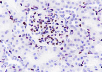 ERG Recombinant Rabbit Monoclonal Antibody