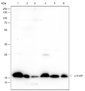 ARPC5 Recombinant Rabbit Monoclonal Antibody