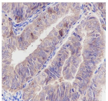 ARPC5 Recombinant Rabbit Monoclonal Antibody