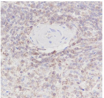 ARPC5 Recombinant Rabbit Monoclonal Antibody