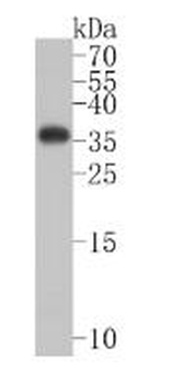 Renilla Luciferase Recombinant Rabbit Monoclonal Antibody