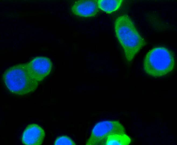 Beta Tubulin Recombinant Rabbit Monoclonal Antibody