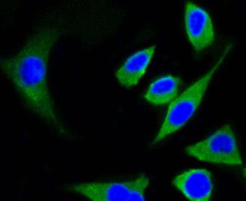 Beta Tubulin Recombinant Rabbit Monoclonal Antibody