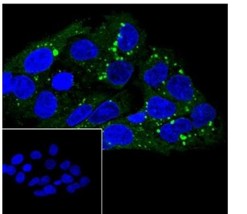 SCARB1/Scavenger Receptor BI Recombinant Rabbit Monoclonal Antibody