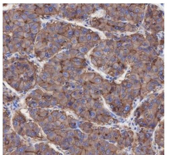 SCARB1/Scavenger Receptor BI Recombinant Rabbit Monoclonal Antibody