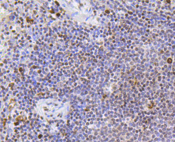 SCARB1/Scavenger Receptor BI Recombinant Rabbit Monoclonal Antibody