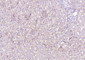 SCARB1/Scavenger Receptor BI Recombinant Rabbit Monoclonal Antibody