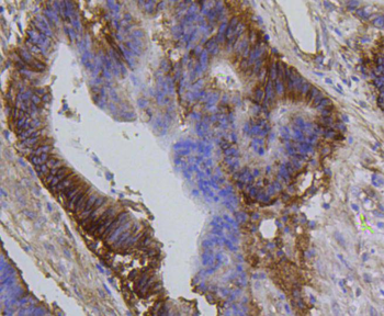Integrin beta 1 Recombinant Rabbit Monoclonal Antibody