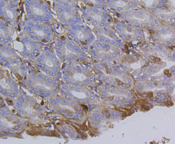 Integrin beta 1 Recombinant Rabbit Monoclonal Antibody