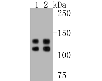 Integrin beta 1 Recombinant Rabbit Monoclonal Antibody