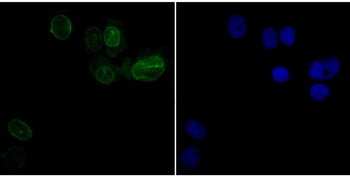 SUN2 Recombinant Rabbit Monoclonal Antibody