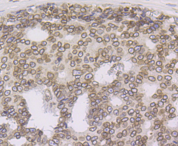 SUN2 Recombinant Rabbit Monoclonal Antibody