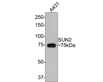 SUN2 Recombinant Rabbit Monoclonal Antibody