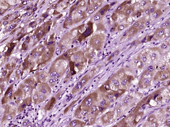 PSMB8 Rabbit Polyclonal Antibody