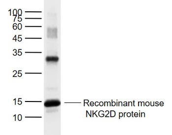 NKG2D Rabbit Polyclonal Antibody