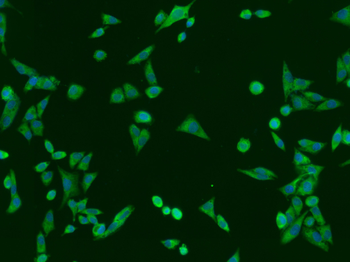 RPS6KA1 Rabbit Polyclonal Antibody