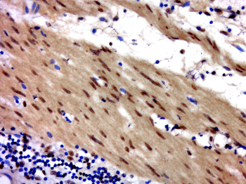 ZNF828 Rabbit Polyclonal Antibody