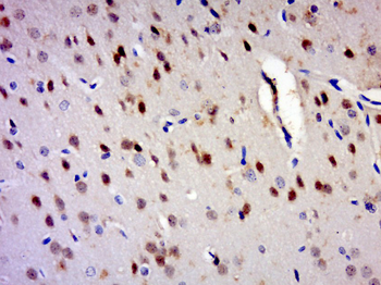 ZNF828 Rabbit Polyclonal Antibody