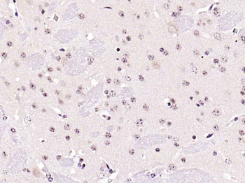 PPAR alpha Rabbit Polyclonal Antibody