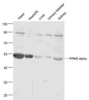 PPAR alpha Rabbit Polyclonal Antibody