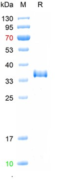 Recombinant SARS-CoV-2 (Omicron, B.1.1.529/BA.2 ) Spike RBD Protein (G339D, S371F, S373P, S375F, T376A, D405N, R408S, K417N, N440K, S477N, T478K, E484A, Q493R, Q498R, N501Y, Y505H)