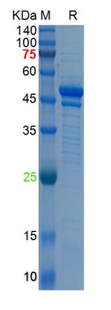 Recombinant MERS-CoV N protein, N-His