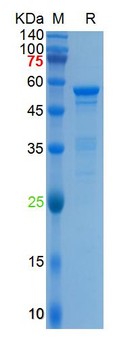Recombinant HCoV-HKU1 N protein, N-His