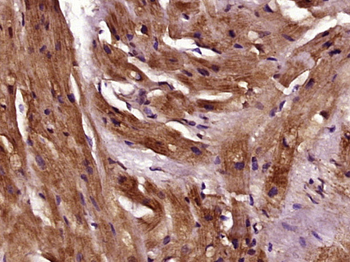 Tropomyosin Rabbit Polyclonal Antibody