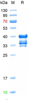 Recombinant mouse CD84 protein, Trx & His