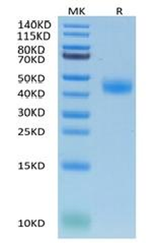 Recombinant Cyn. monkey CD122 / IL2RB protein, C-His (HEK293)
