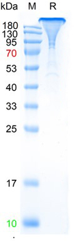 Recombinant SARS-Cov-2 Spike protein, Fc & Avi (HEK293)