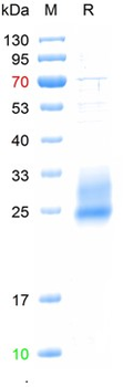 Recombinant mouse CD160 protein, C-His Tag (HEK293)