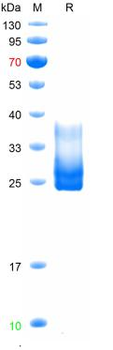 Recombinant human TGFBR2 protein, C-His (HEK293)