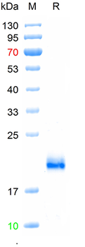Recombinant mouse IL-4 protein, His (HEK293)