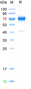 Recombinant human AFP protein, C-His (HEK293)