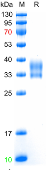 Recombinant human IGFBP6 protein, C-His (HEK293)